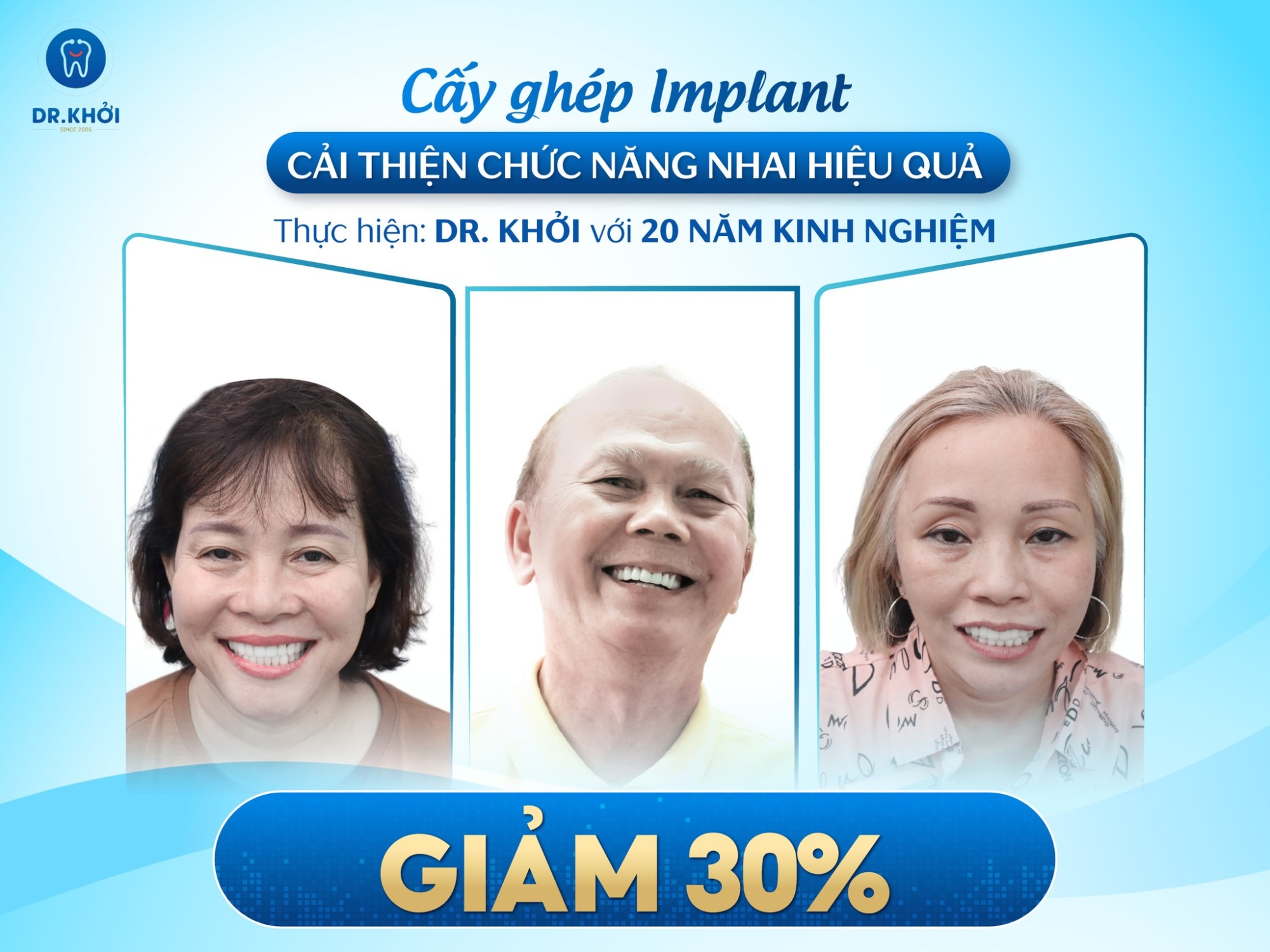 Implant service